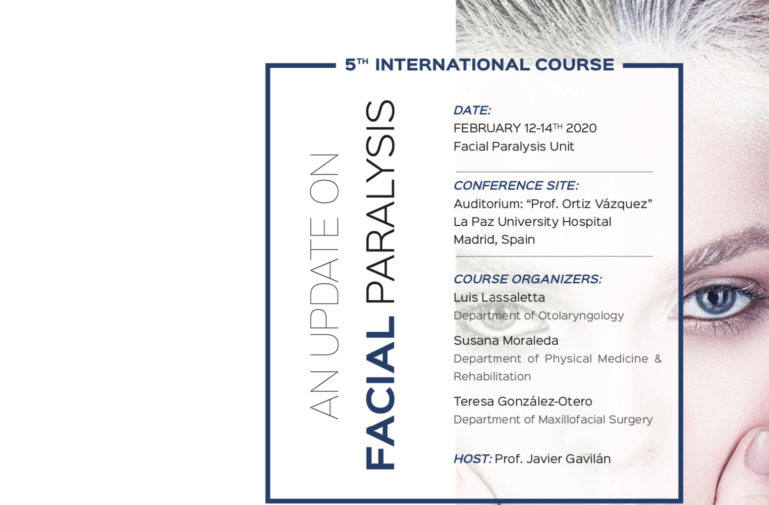 Hearring course facial paralysis